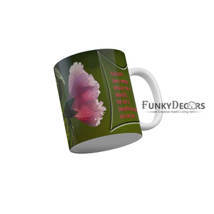 She is beautiful beacause you love her Coffee Ceramic Mug 350 ML-FunkyDecors